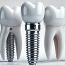 예원치과의원 | 서울 중구 필동 임플란트 치과 가격 비용 싼 곳,저렴한 곳,잘하는 곳,유명한 곳 BEST5 추천