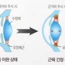 마이미르안경
