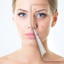 압구정필성형외과의원 이미지