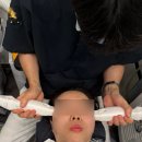 써니지니 | 판교역 피부과 써니리프팅 잘하는곳 팔자주름 리프팅 후기