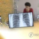 "폐렴 사망자 10명 중 9명이 노인…고열·기침·가래 잘 살펴야" 이미지