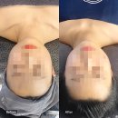 [공지] 에스테티아 망우역점 근육이완 갸름한 얼굴 효과 만점 윤곽 관리 후기