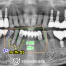 주안시카고치과의원 네이버블로그