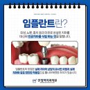 안양맥치과의원 네이버블로그