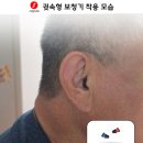 시그니아 독일보청기 이미지