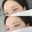 키닛브로우바