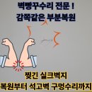 벽빵꾸수리 찢긴 실크벽지 부분복원 후기