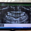 휴부부치과의원 이미지