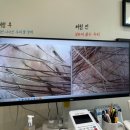 굿프라임2빌딩 | 탑스칼프 송파점, 두피 열 많은 사람, 탈모 예방, 두피스켈링, 체험하러 갔다가 제품까지 사버린 찐 후기