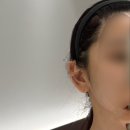 강한피부과의원 | [신풍역 피부과] 원장님 상담부터 진료까지 직접하는 ‘안톤의원’ 텐서마 받은 후기 (+목요일 야간진료)