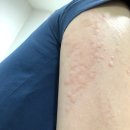 경애약국 | 15일간 김포경애한의원 한약 복용 후기에요.