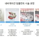 윌플란트치과의원 이미지