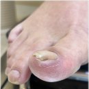 대덕대로168번길 | 대전 탄방동 내성발톱 오래된 전문샵 방문 후기 네일의아침