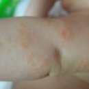 에스알메디 이미지