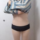 오렌즈대구점 | 대구 복부지방흡입 당일 직후부터 1주일차까지 후기 (통증,붓기,멍)