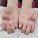 [대구 수성구 네일샵] 물어뜯는 손톱 아크릴 연장💅 ▪️네일라헨느▪️