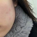 아름 한의원 | [비대칭/턱관절교정] 아름턱한의원 상담 &amp; 1회차 내돈내산 후기 (지인소개 할인 방법)