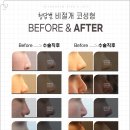 청담별의원 네이버블로그