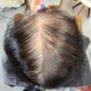 매트로펠리스Ⅱ-B | 중동천연염색 큐사랑 부천지사 , 엄마 두피케어 받고 온 솔직후기