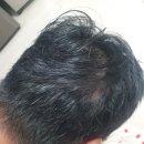 제일지엔에스 | [지엔에스]지엔실 샴푸/탈모고민 해결/손상모 탈출/탈모방지 헤어그로스 샴푸 솔직후기