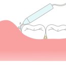 서울유치과병원 네이버블로그