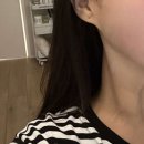 청담포레브의원 네이버블로그