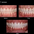 라라치과기공소 이미지