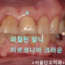 서울단오치과의원 네이버블로그