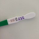 강원대학교병원어린이집 | 임신과 자궁수축 · 조기진통으로 인한 입원 기록