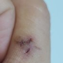 강남초이스정형외과의원 이미지