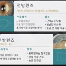 누네빛안경 네이버블로그