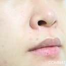 바이퓨어 이미지