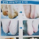 헤드샷스칼프본점 이미지