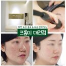 대전피부관리 프롬미 대전점 모공 홍조 관리 바이오힐 솔직후기