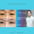 S성형외과의원 | 안검황색종 재발 원인 및 수술 원칙 비용 후기 전후 비교 (성형외과 전문의)