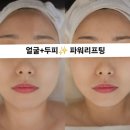 옥정동로 | 옥정피부관리 파워리프팅- 얼굴+두피까지 확실히 끌어올린 후기✨