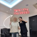 성북20 | 명동다이어트약 안먹는데 17kg 쥬비스성북 뺀 20대후기