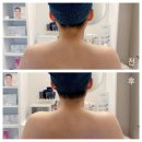 세븐일레븐 광주와이어스파크점 | 광주첨단피부관리 승모근 어깨마사지 독소케어 잘하는 로라뷰티하우스