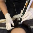 어나더핏 | 리프팅의 끝판왕 에어샷 후_진주피부관리 인오프어나더