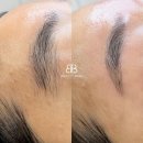 뷰티빈즈