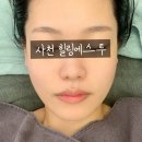 일진세탁소 | 사천 에스테틱 힐링에스투 피부관리 후기 꿀피부 만들기
