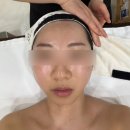 왕후에스테틱 | 세종 피부관리 더스킨코드(예신 관리 추천)