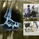 바이오오소틱 이미지