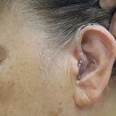 스마트보청기 청각언어센터 이미지