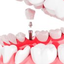 율하위치과의원 이미지