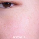 미라클리치 주식회사 | 톡스앰플 안티에이징화장품으로 홈케어해봤어요!