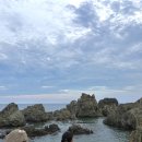 구일약국 | 수술기록(2) 쌍수 절개 실밥제거 후 붓기관리 일주일차