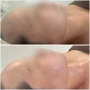 나조각에스테틱