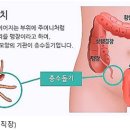 (인체미생물) 03. 충수와 자연선택 이미지