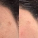 129뷰티 | 왕십리피부관리 리디아뷰티 촉촉 물광피부 만들기